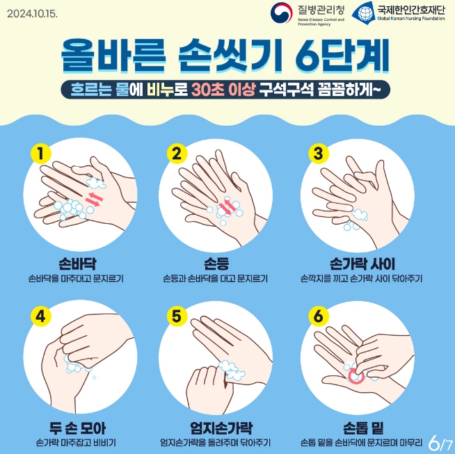 오산시, 수두 발생 증가에 따른 예방수칙 준수 당부